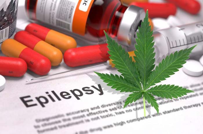 “Cannabis and Epilepsy”